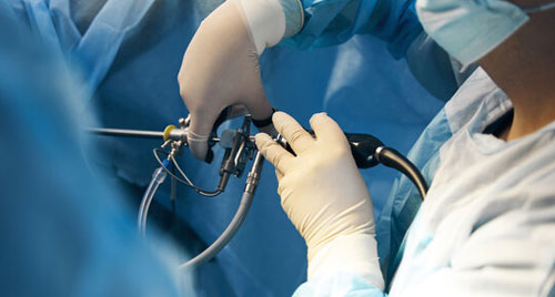 Minimally Invasive Surgery